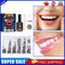 DIY Tooth Gem Kit Multifunctional with Curing Light Glue Professional Ornament