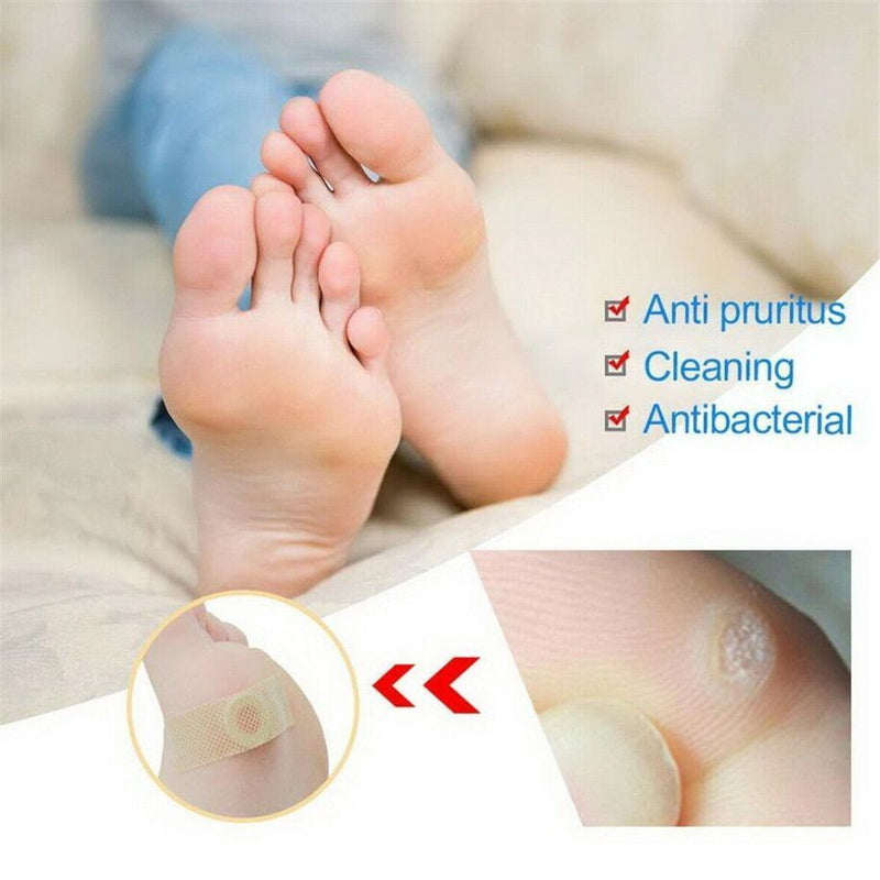Wart Stick Wart Freeze Corn Removers For Feet Wart Remover Wart Remover Pads