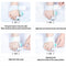 Foot Care Toe Corrector Hallux Valgus Correction Bunion Splint Toe Separator