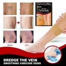 Varicose Veins Patches Leg Spider Relief Promote Metabolism Phlebitis Plaster