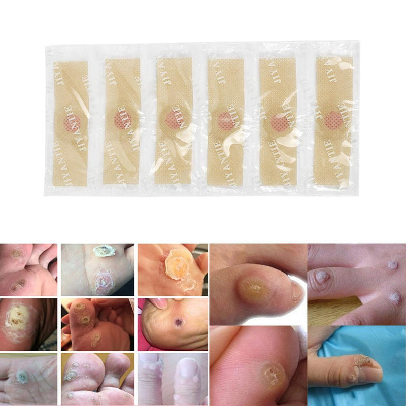 12pcs/set Foot Care Stickers Medical Plaster Chicken Eye Corns Patches