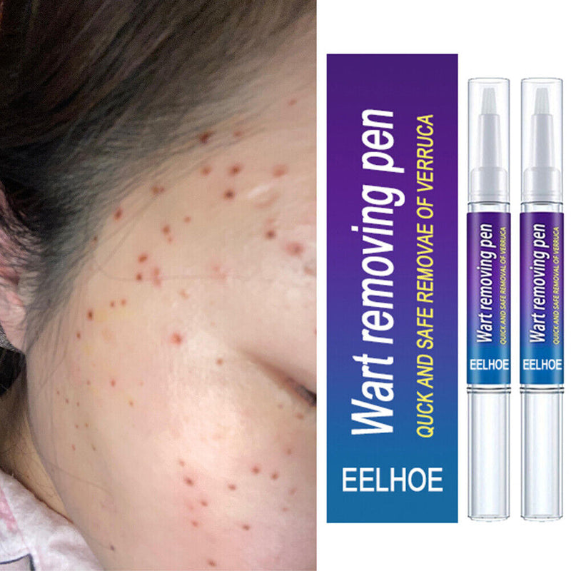 2pcs Wart Remover Skin Tag Pen Safe Herbal Ingredients Medicine Ointment Tools