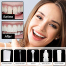 Reusable Tooth Repair Granules Temporary Tooth Kit Repair H4Q9