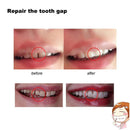 10g Denture Solid Glue Dental Restoration Temporary Tooth Repair Kit (10g) Newly