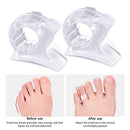 Silicone Toe Separator Ring Feet Protector for Toe Orthopedic Products (B) Newly