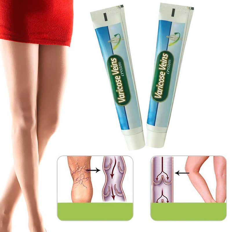 Ointment Vasculitis Phlebitis Spider Veins Pain Varicosity Remedy Herbal Cr