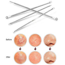 4PCS Blackhead Extractor Dots Cleaner Pore Cleaning Set Acne Tool Needles V5H0