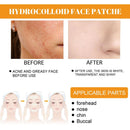 4Sheets Mighty Patch Nose Pores Cleansing Cosmetics Hydrocolloid Patch R8K5