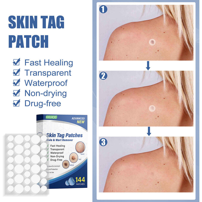 #A 144pcs Skin Tag Remover Patches Breathable Wart Treatment Stickers Cleaning