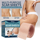 Flaw Hide Tape Birthmark Scar Acne Tattoo Cover Up Concealing Hide Stickers`