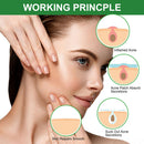 24pcs Ultra-thin Acne Pimple Remover Patches Acne Treatment Stickers Kit Newly