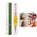 Pen Enhance Damaged Cuticles Nail Repair Oil Moisturizing Nail Cuticle Care