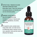 Narbenentfernung Ätherisches Öl Dehnungsstreifen Akneflecken Narbenchirurgie.