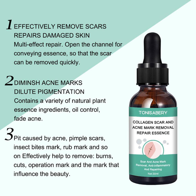 Narbenentfernung Ätherisches Öl Dehnungsstreifen Akneflecken Narbenchirurgie.