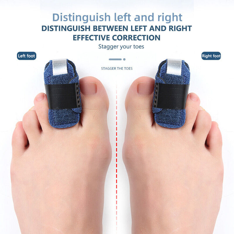 Finger Fixing Splint Straighten Braces Support Adjustable Wrap Foot Care Tool