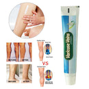 Ointment Vasculitis Phlebitis Spider Veins Pain Varicosity Remedy Herbal Cr
