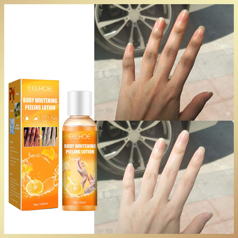 Whitening Peeling Gel Remove Dead Skin for Finger Knee Armpit Dark Skin Body