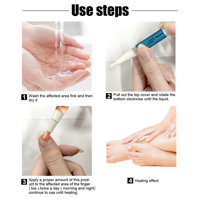 Fungal Nail Treatment Pencil Anti Fungus Biological Repair Nail Oil (1pc)