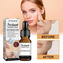 Pore Shrink Face Serum Oil Control Remove Dark Spots Whitening Essence: