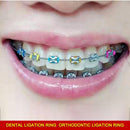 Orthodontic Ties Rings Non-latex 20 Stick Ligature Ties Tool Assorted for B