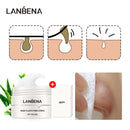 LANBENA 60pcs Blackhead Remover Nose Peeling Masks Pore Cleansing Skin Care