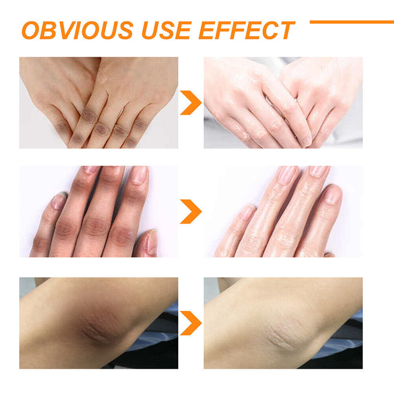 Whitening Peeling Gel Remove Dead Skin for Finger Knee Armpit Dark Skin Body