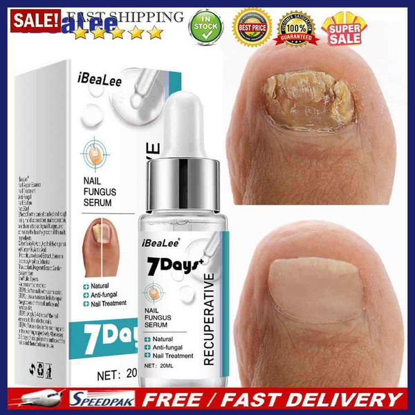 20ml Nail Repair Fluid Anti Infection Paronychia Essence Effective for Foot Care