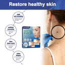 Skin Tag Remover Patches Acne Pimple Moles Wart Remover 144 Pcs`