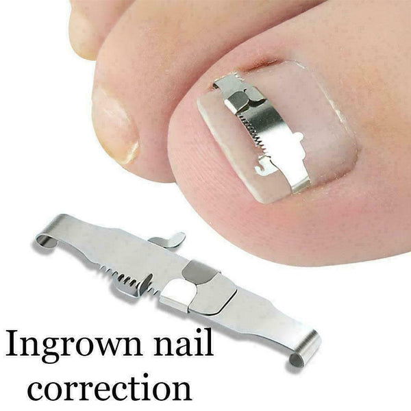 2PCS Ingrown Toe Nail Fixer Embed Toenail Correction Pedicure Tool Lifter M7Q6
