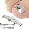 2PCS Ingrown Toe Nail Fixer Embed Toenail Correction Pedicure Tool Lifter M7Q6