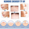 Warts Remover Patch Skin Tag Remover Acne Spot Treatment Anti Verruca Remedy