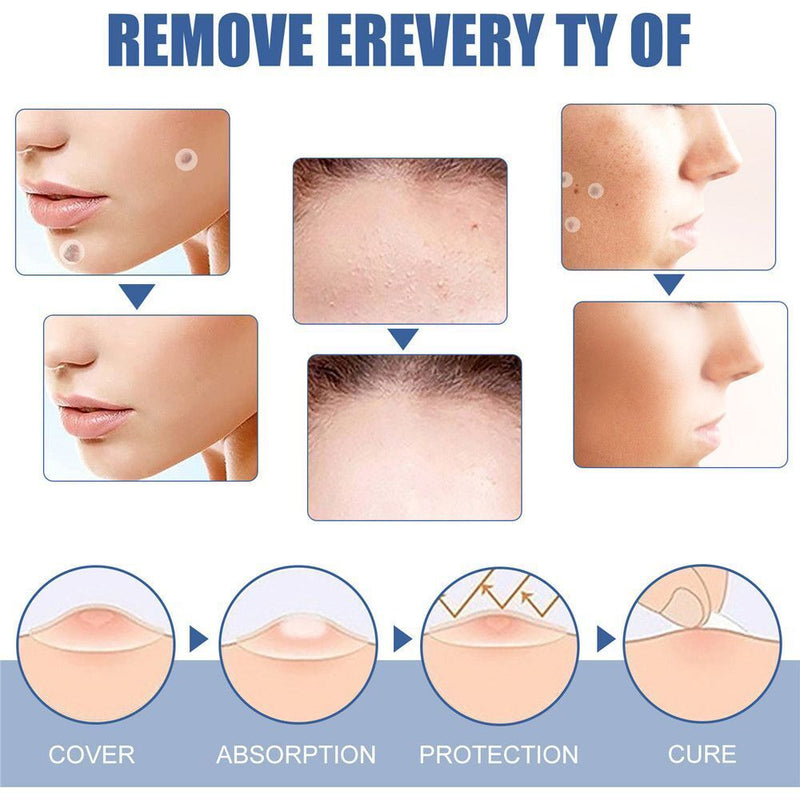 Warts Remover Patch Skin Tag Remover Acne Spot Treatment Anti Verruca Remedy