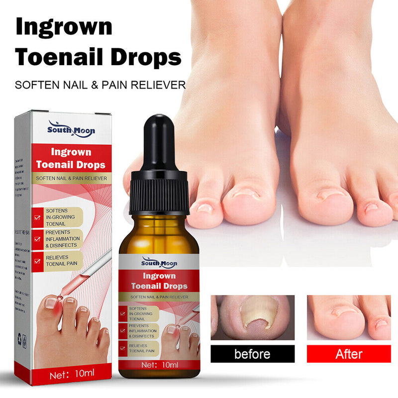 Nail Correction Recover Oil Trim with Ease Oil Feet Health Care Safe for All Age
