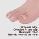 10pcs Toenail Correction Pedicure Tool Clip Set Invisible Ingrown Treatment