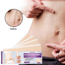 4pcs Silicone Scar Sheets Gel Strips Patch Adhesive Scar Removes (150mm)