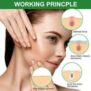 24 Pcs Skin Tag Remover Pimple Master Patch Treatment U2K7 Acne Stickers K0D4
