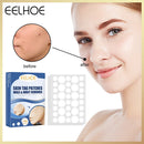 144pcs Skin Tag Remover Patches Wart Treatment Herbal Stickers Plasters Newly