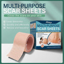 Skin Tone Concealer Tattoo Stickers Cover Up Scars Birthmark Patch Waterproof