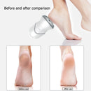 Electric Foot Grinder Vacuum Dead Skin Callus Remover Hard Cracked Skin Files