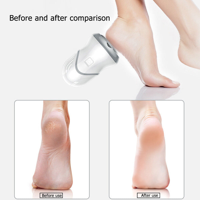 Electric Foot Grinder Vacuum Dead Skin Callus Remover Hard Cracked Skin Files