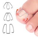 Ingrown Toe Nail Correction Hook/Rubber Band Paronychia Orthosis Corrector Clips