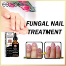 Nail Repair Fluid Health Care Foot Treatment Onychomycosis Paronychia Improve