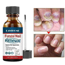 Nail Repair Anti Fungal Nail Infection Onychomycosis ml 10 D7D8 M6G7 M6J4 J8F5