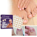 Ingrown Nail Treatment Stickers Toenail Correction Patches Unisex Nail Care Tool