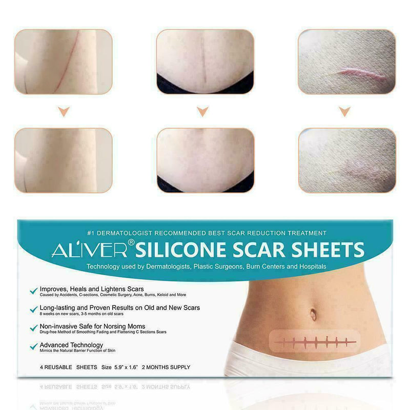 ALIVER 4pcs Silicone Scar Gel Away Strips Scar Remover Treatment Reusable V2I7