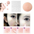 Hydrocolloid Invisible Acne Patch Acne Pimple Master Patch 15 Patches (4pcs
