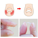 10pcs Ingrown Toenail Straightening Clip Curved Brace Toenails Correction  Newly