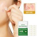 36 Patches Waterproof Acne Pimple Patch Stickers Acne FAST Pimple Remover H8K1