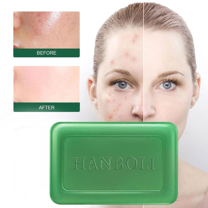 Wormwood Soap Anti-fungal Anti-itch Mites Acne Bath Soap Oil Control.