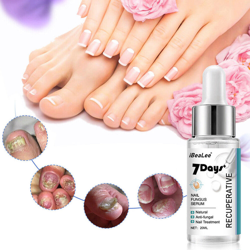 20ml Nail Repair Fluid Anti Infection Paronychia Essence Effective for Foot Care
